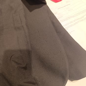 Pierre Cardin Ceket 20 Günde Aşırı Tüylenme Ve Müşteri Mağduriyeti