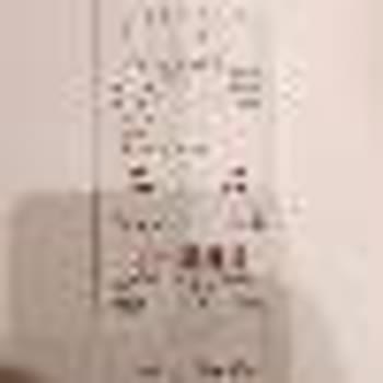 Ayıplı Pantolonun Ayakkabıya Zarar Vermesi Ve Mağazanın İlgisizliği