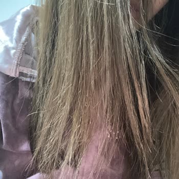 My Dyson Airstrait Burned My Hair After Just 3 Uses and Support Refused to Help