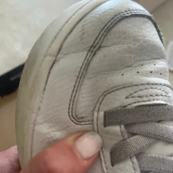 Skechers’tan Alınan Ayakkabılar Kısa Sürede Yırtıldı, Mağduriyetim Giderilmiyor