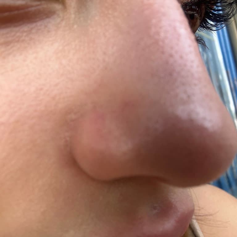 Selin Beauty Center Aynı Pakete Farklı Uygulama ve Sonuçsuz Cilt Bakımı Deneyimi