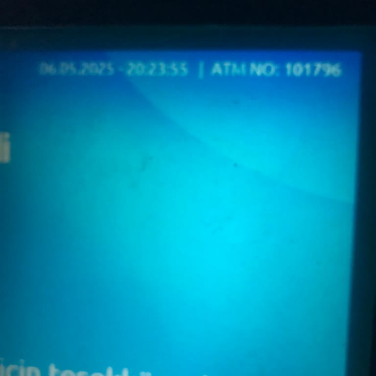 ATM'de QR İle Yatırdığım Para Sıkıştı Mağduriyetim Ne Zaman Giderilecek