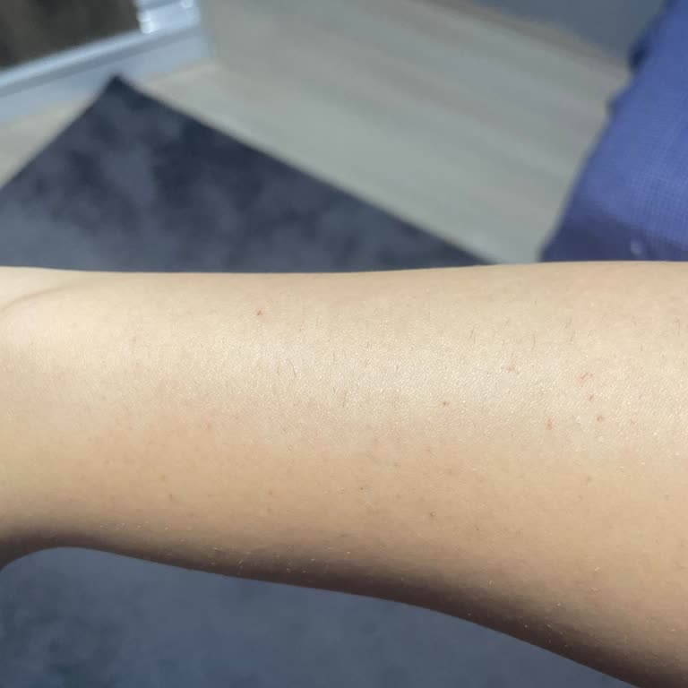 Deneme Atışında Yanık Ve İlgisizlik Yaşadım