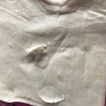 Milföy Hamurunda Saç Çıktı, Hijyen Ve Dikkat Eksikliği