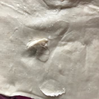 Milföy Hamurunda Saç Çıktı, Hijyen Ve Dikkat Eksikliği