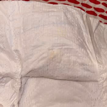 Prima Premium Care Bebek Bezinde Sert Cisimle Karşılaştım, Bebeğimin Sağlığı Tehlikede