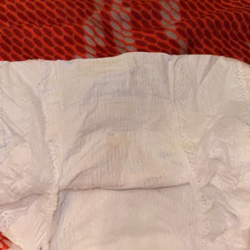 Prima Premium Care Bebek Bezinde Sert Cisimle Karşılaştım, Bebeğimin Sağlığı Tehlikede