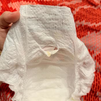 Prima Premium Care Bebek Bezinde Sert Cisimle Karşılaştım, Bebeğimin Sağlığı Tehlikede