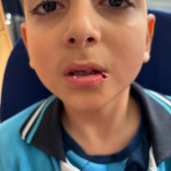 Okulda Akran Zorbalığına Karşı Yetersiz Önlem Nedeniyle Çocuğum Mağdur Oldu