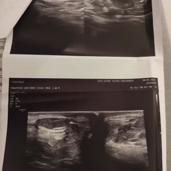 E-Nabız Bilgileri Varken Gereksiz Fotokopi Talebi