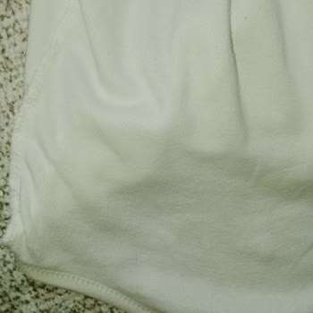 Prima 5 Numara Bebek Bezi Sızdırma Sorunu Yaşıyorum