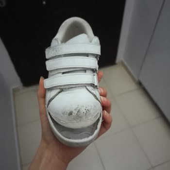 Bir Ayda Parçalanan Çocuk Ayakkabısına Kullanıcı Hatası Denmesi