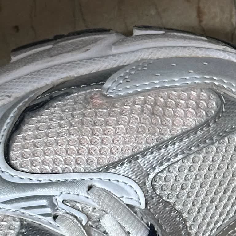 New Balance Bir Yıl Dolmadan Kullanılamaz Hale Gelen Ayakkabı Ve Garanti Sorunu