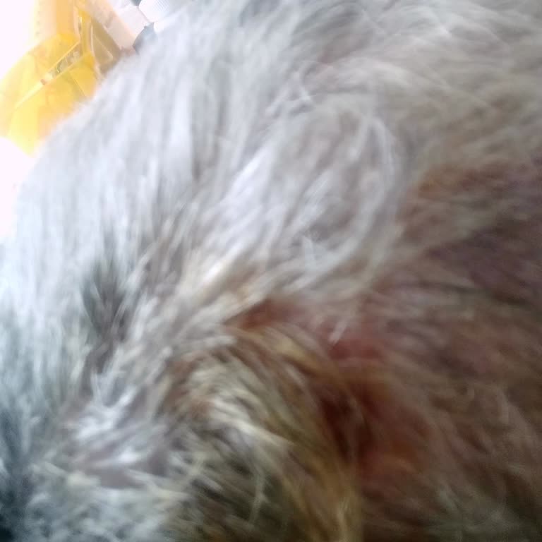 Beyin Pili Ameliyatı Sonrası Kablo Bölgesinde Tekrarlayan Yara Ve Enfeksiyon Riski