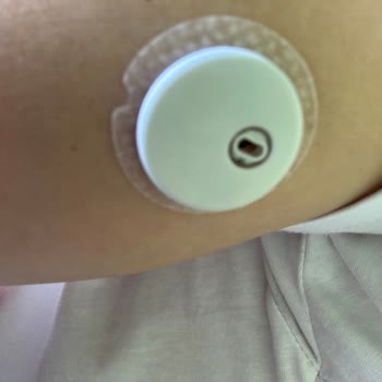 Freestyle Libre 3 Uygulamasında Sürekli Hata Alıyorum