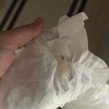 Bebek Bezinde Yabancı Cisim Tedirginliği