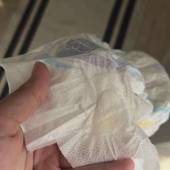 Bebek Bezinde Yabancı Cisim Tedirginliği