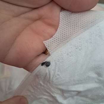 Bebek Bezinde Boya Kalıntısı Ve Firma İlgisizliği