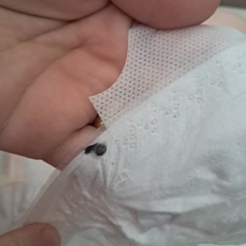 Bebek Bezinde Boya Kalıntısı Ve Firma İlgisizliği
