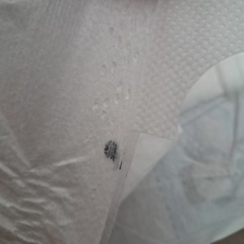 Bebek Bezinde Boya Kalıntısı Ve Firma İlgisizliği