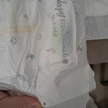 Bebek Bezinde Boya Kalıntısı Ve Firma İlgisizliği