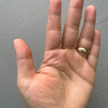 Cif Spreyi Ellerde Ciddi Tahrişe Sebep Oldu