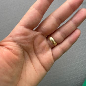 Cif Spreyi Ellerde Ciddi Tahrişe Sebep Oldu