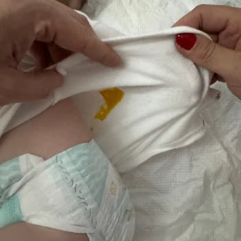 Prima 3 Numara Bebek Bezi Büyük Tuvaleti Kaçırıyor, Firma Dönüş Yapmıyor