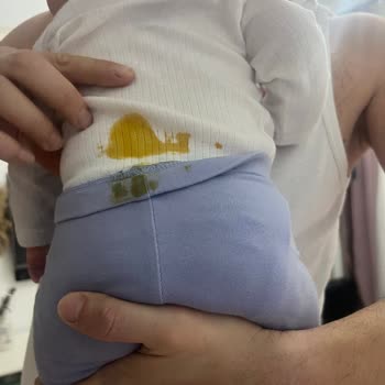 Prima 3 Numara Bebek Bezi Büyük Tuvaleti Kaçırıyor, Firma Dönüş Yapmıyor