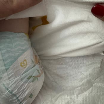 Prima 3 Numara Bebek Bezi Büyük Tuvaleti Kaçırıyor, Firma Dönüş Yapmıyor