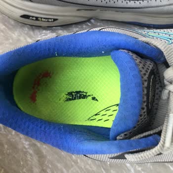 Garantiyle Alınan Ayakkabı Kısa Sürede Yırtıldı, Mağduriyetim Giderilmedi