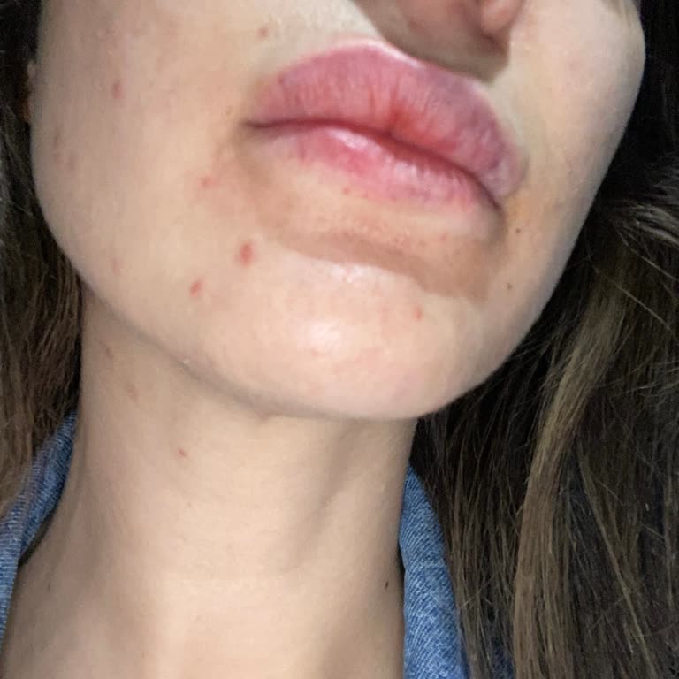 Dr. Alpay Yıldız Memnun Kalmama