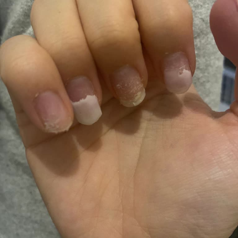 Kalitesiz Malzeme Ve Değişen Fiyatlarla Kötü Tırnak Deneyimi