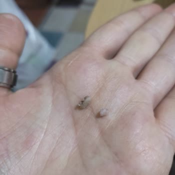 Kebap Ürününde Beklenmedik Kemik Parçalarıyla Karşılaştım