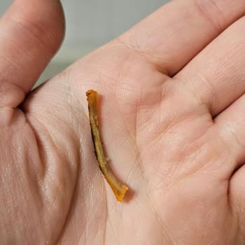 Hazır Tavuk Dönerde Kemik Parçası İle Karşılaşmak