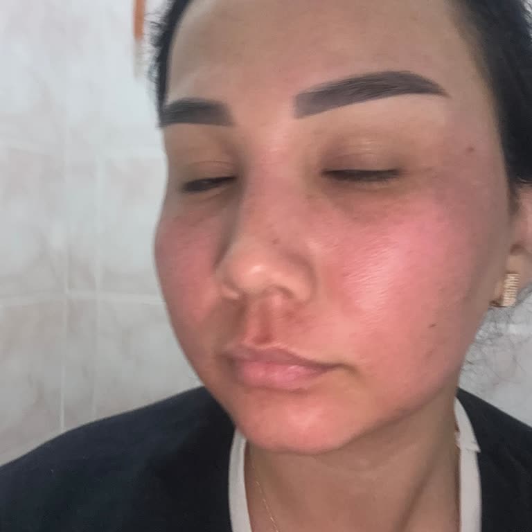 Bioderma Pigmentbio Serum İlk Kullanımda Yoğun Yanma Ve Kızarıklık Yaptı