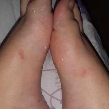 Aldo Shoes Ayağımı Mahvetti