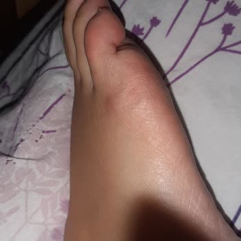 Aldo Shoes Ayağımı Mahvetti