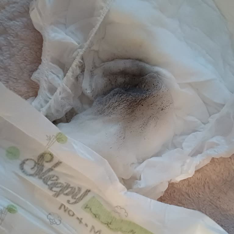 Sleepy Bebek Bezinde Beklenmedik Sorunlar Ve Cilt Tahrişi