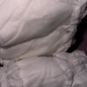 Sleepy Bebek Bezinde Yabancı Madde ve Yetersiz Müşteri Hizmeti