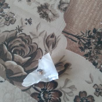 Satın Aldığım Üründen Plastik Atık Çıktı, İade Sonrası Özür Bile Dilenmedi