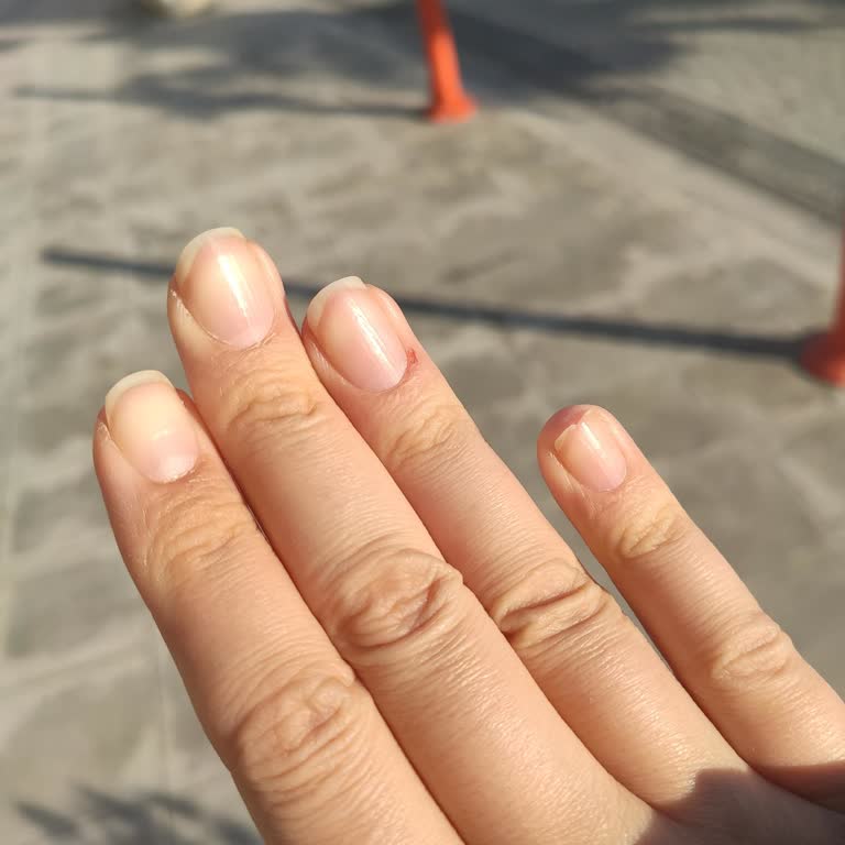 Kötü Manikür Deneyimi Ve Telafi Edilmeyen Hatalar