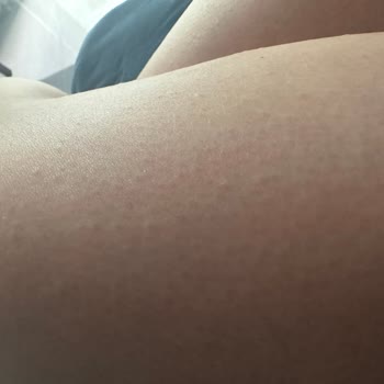 Yves Rocher Vanilyalı Vücut Losyonu Cildimde Döküntü Ve Kaşıntı Yaptı