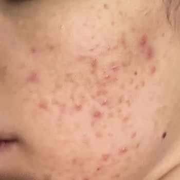 Satıcıdan Aldığım Ürün Cildime Zarar Verdi Ve Orijinal Değildi