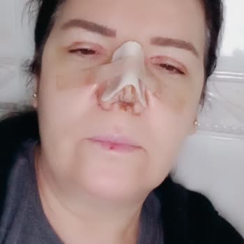 Ameliyat Sonrası Memnuniyetsizlik Ve Güven Sorunu