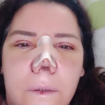 Ameliyat Sonrası Memnuniyetsizlik Ve Güven Sorunu