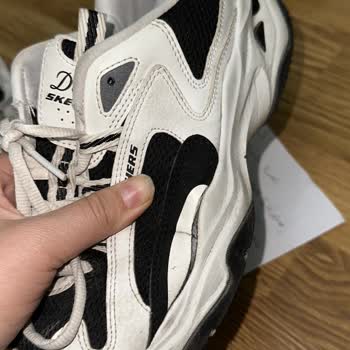 Skechers Ayakkabıda Üretim Hatasına Çözüm Sunulmadı, Müşteri Mağdur Edildi