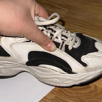 Skechers Ayakkabıda Üretim Hatasına Çözüm Sunulmadı, Müşteri Mağdur Edildi