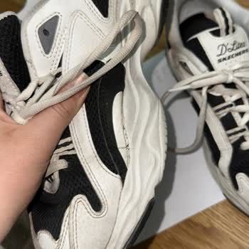 Skechers Ayakkabıda Üretim Hatasına Çözüm Sunulmadı, Müşteri Mağdur Edildi