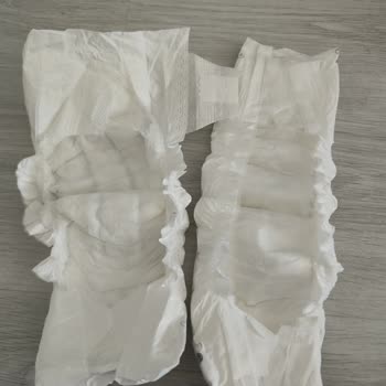 Sleepy Bio Natural Bezde Kalite Düşüşü Ve Sürekli Pişik Sorunu